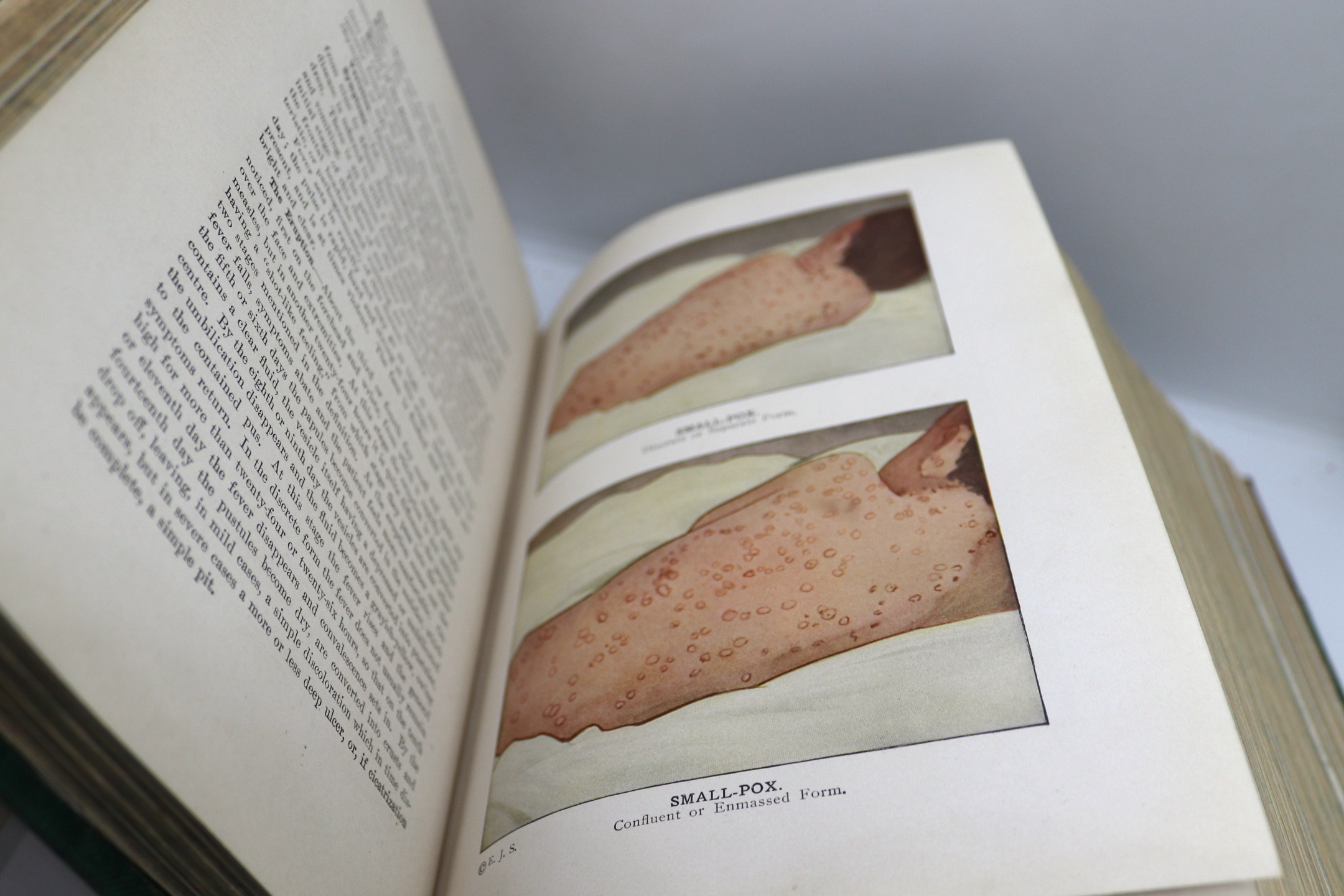 Library of Health: Prevention & Cure 1916 1st ed - Image 15