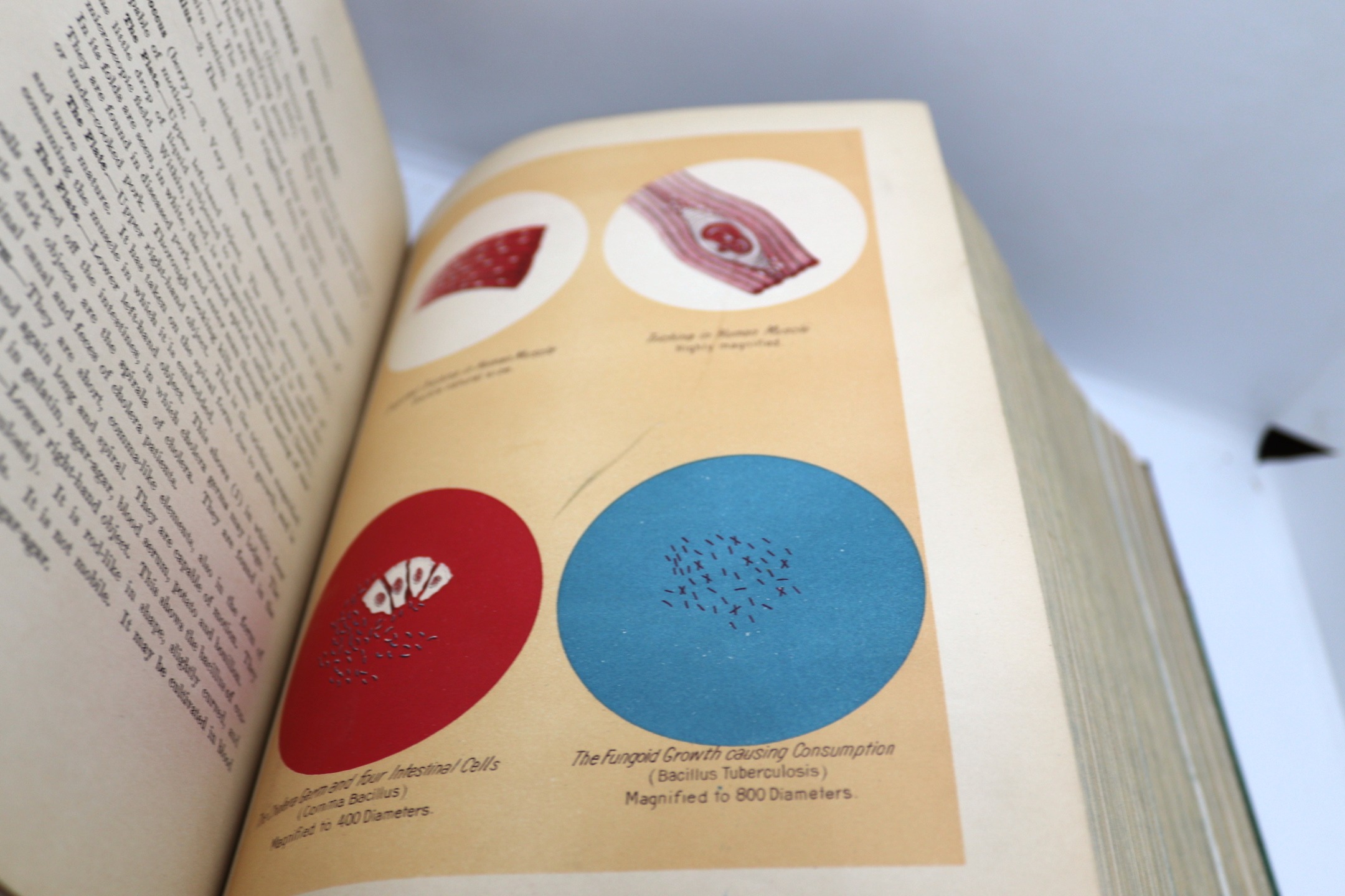 Library of Health: Prevention & Cure 1916 1st ed - Image 16